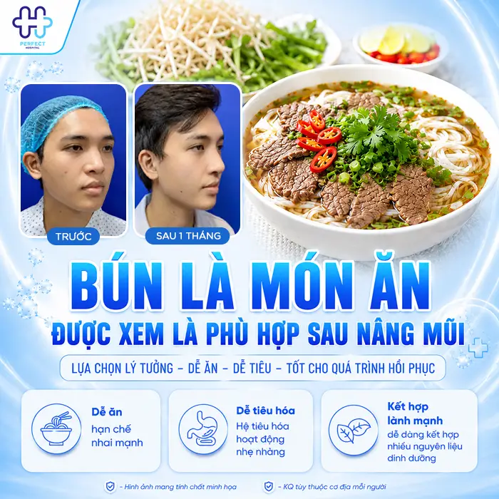 Nâng Mũi Có Được Ăn Bún Không? Có Ảnh Hưởng Đến Mũi Không?