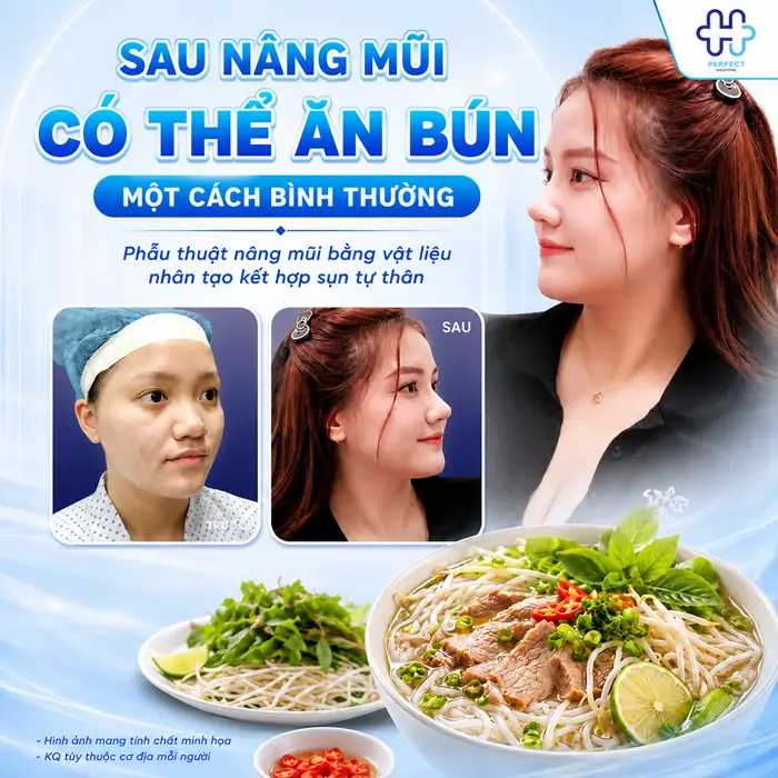 Nâng Mũi Có Được Ăn Bún Không? Có Ảnh Hưởng Đến Mũi Không?