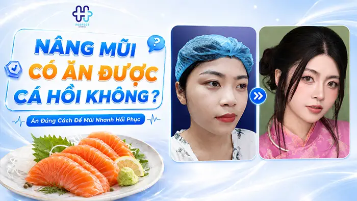Nâng Mũi Có Được Ăn Cá Hồi Không? Ăn Đúng Cách Để Mũi Nhanh Hồi Phục