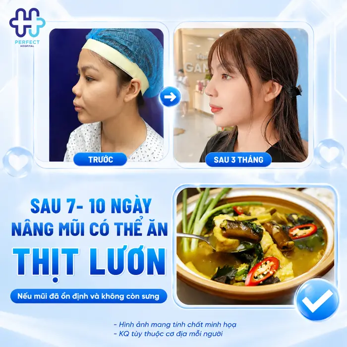 Nâng Mũi Có Ăn Được Lươn Không? Chuyên Gia Giải Đáp Chi Tiết