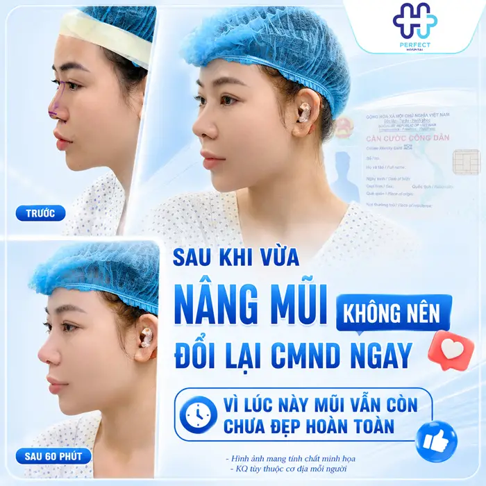 Nâng Mũi Có Cần Làm Lại CMND Không? Giải Đáp Mới Nhất