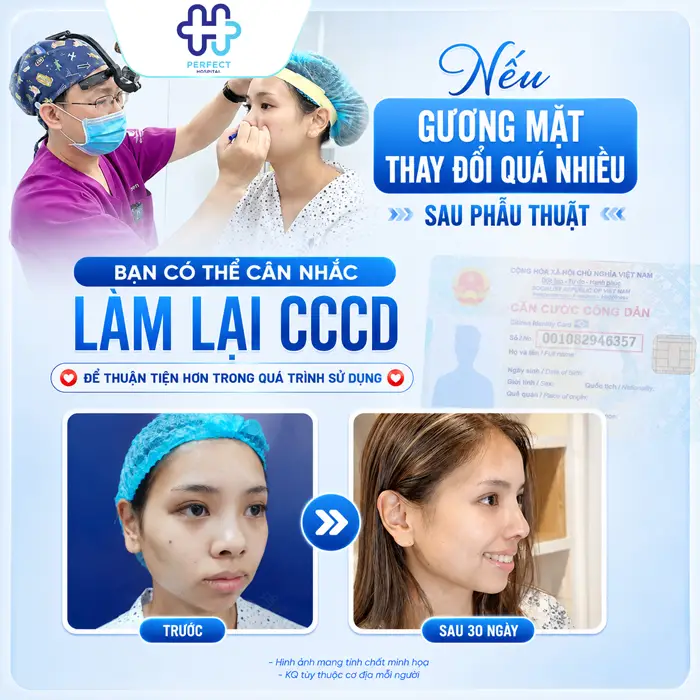 Nâng Mũi Có Cần Làm Lại CMND Không? Giải Đáp Mới Nhất