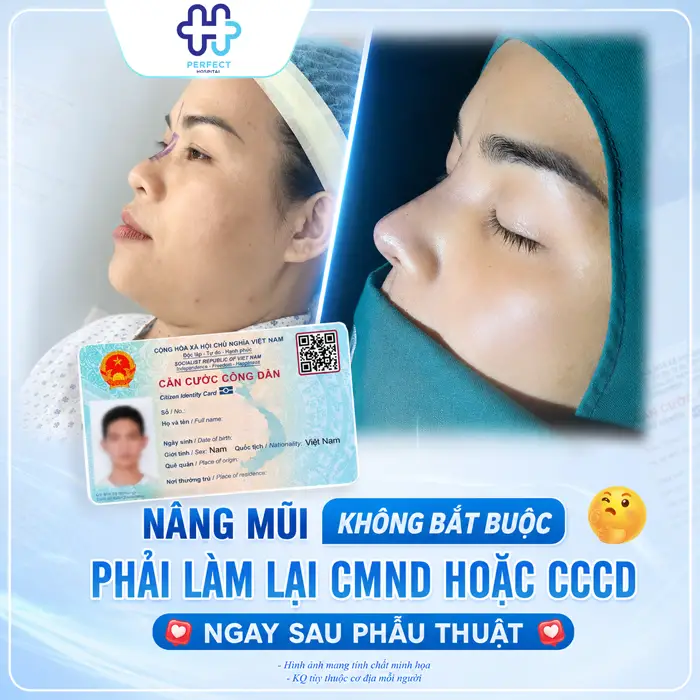 Nâng Mũi Có Cần Làm Lại CMND Không? Giải Đáp Mới Nhất