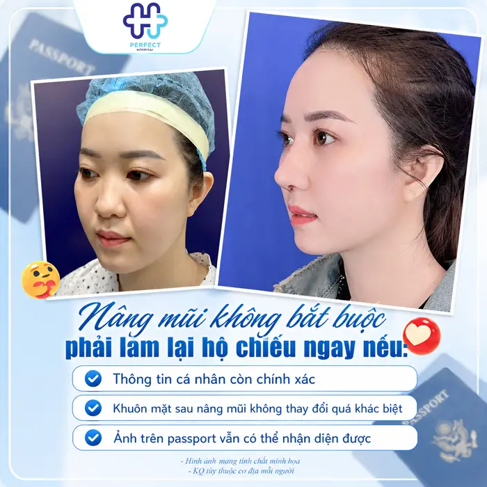 Nâng Mũi Có Cần Làm Lại Hộ Chiếu Không? Giải Đáp Chi Tiết
