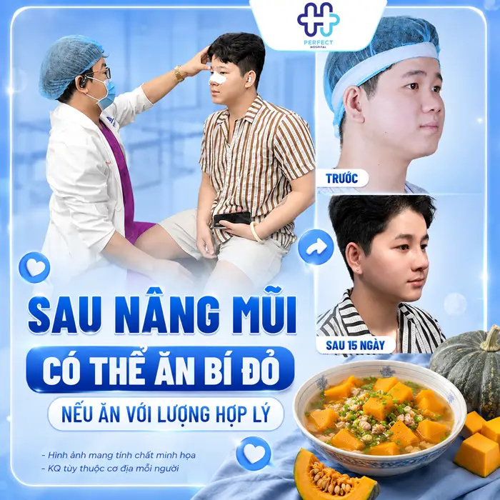 Nâng Mũi Có Được Ăn Bí Đỏ Không? Khi Nào Nên Ăn Sau Nâng Mũi
