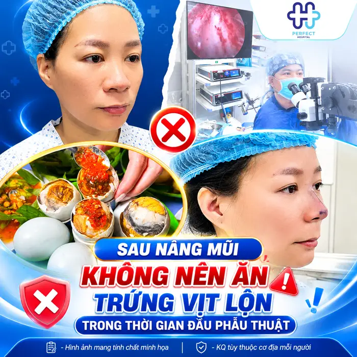 Nâng Mũi Có Được Ăn Trứng Vịt Lộn Không? Giải Đáp Chi Tiết