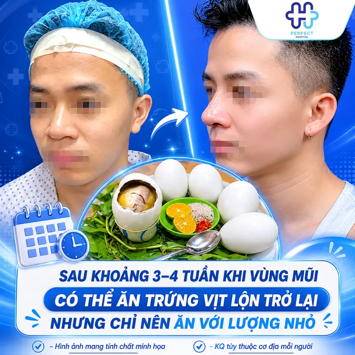 Nâng Mũi Có Được Ăn Trứng Vịt Lộn Không? Giải Đáp Chi Tiết