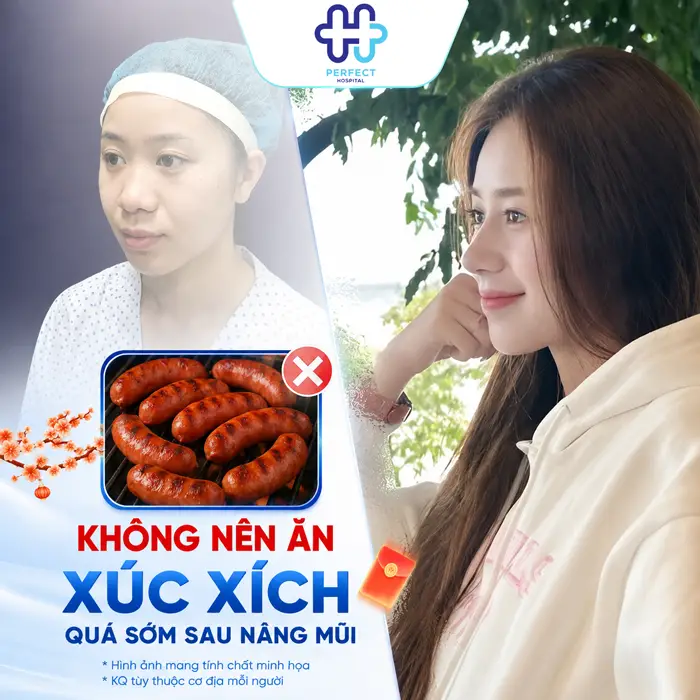 Nâng Mũi Có Được Ăn Xúc Xích Không? Chuyên Gia Giải Đáp