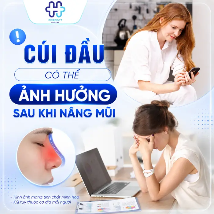 Nâng Mũi Có Được Cúi Đầu Không? Chuyên Gia Giải Đáp Chi Tiết