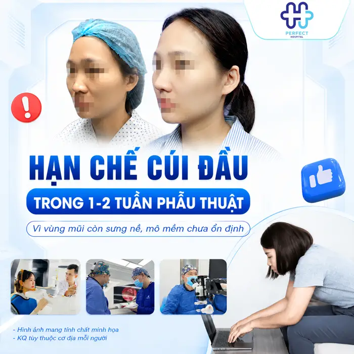 Nâng Mũi Có Được Cúi Đầu Không? Chuyên Gia Giải Đáp Chi Tiết