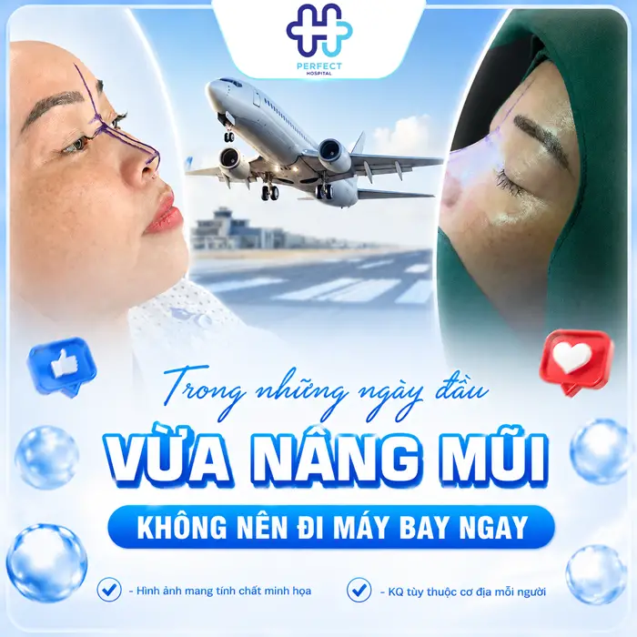 Nâng Mũi Có Được Đi Máy Bay Không? Giải Đáp Từ Chuyên Gia