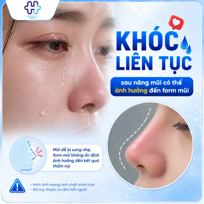 Nâng Mũi Có Được Khóc Không? Những Điều Cần Lưu Ý Sau Phẫu Thuật
