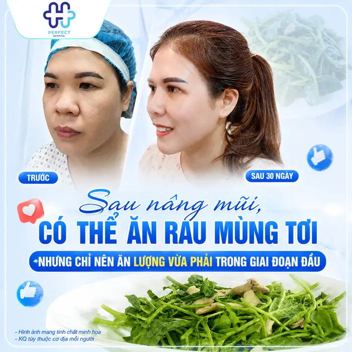 Nâng Mũi Có Nên Ăn Rau Mùng Tơi Không? Chuyên Gia Giải Đáp