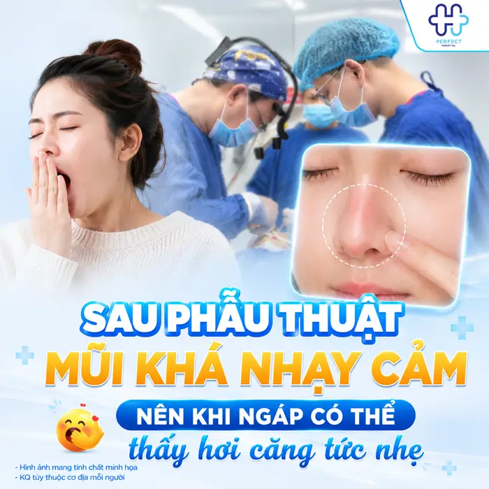 Nâng Mũi Có Được Ngáp Không? Những Điều Cần Lưu Ý Sau Phẫu Thuật