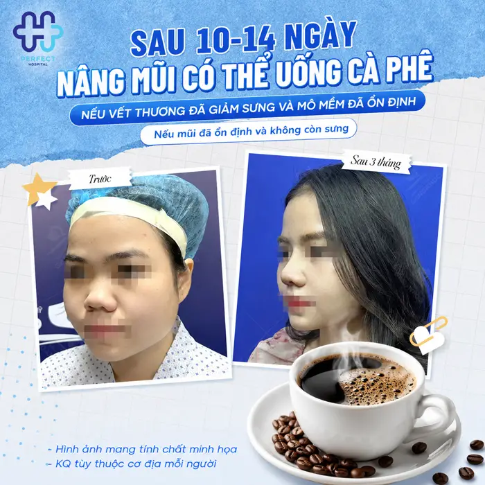 Nâng Mũi Có Được Uống Cafe Không? Chuyên Gia Giải Đáp Chi Tiết