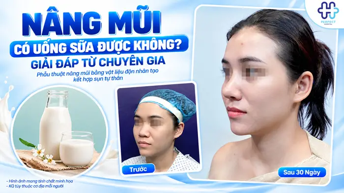 Nâng Mũi Có Uống Sữa Được Không? Giải Đáp Từ Chuyên Gia