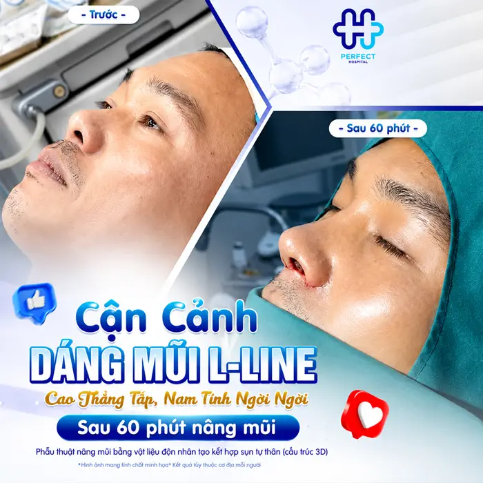 Nâng Mũi Nam Ở Đâu Đẹp? Tiêu Chí Chọn Địa Chỉ Uy Tín Cho Phái Mạnh