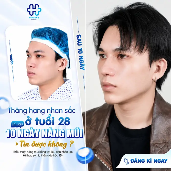 Nâng Mũi Nam Ở Đâu Đẹp? Tiêu Chí Chọn Địa Chỉ Uy Tín Cho Phái Mạnh