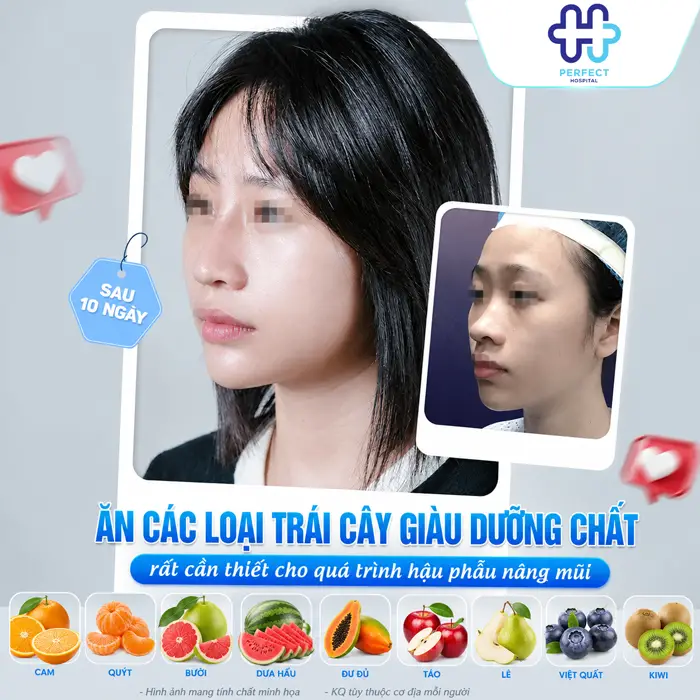 Nâng Mũi Nên Ăn Trái Cây Gì Để Mũi Nhanh Lành, Đẹp Tự Nhiên?