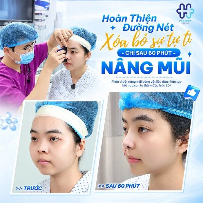 Nâng Mũi S Line Bao Lâu Thì Đẹp? Thời Gian Lành Và Vào Form