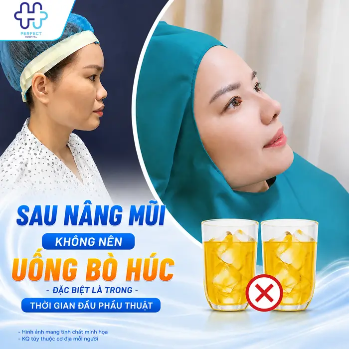 Nâng Mũi Uống Bò Húc Được Không? Những Điều Cần Lưu Ý Sau Nâng Mũi