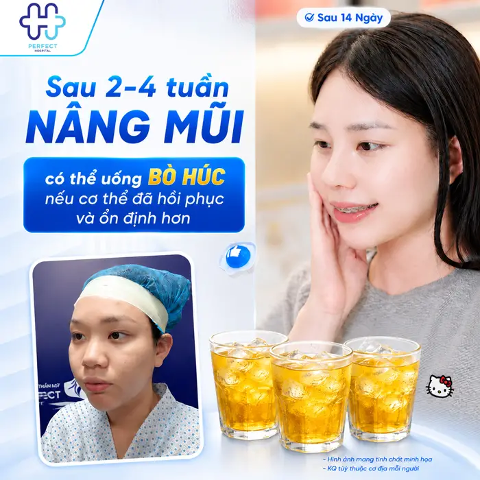 Nâng Mũi Uống Bò Húc Được Không? Những Điều Cần Lưu Ý Sau Nâng Mũi