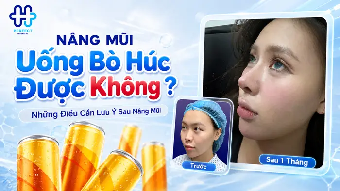 Nâng Mũi Uống Bò Húc Được Không? Những Điều Cần Lưu Ý Sau Nâng Mũi