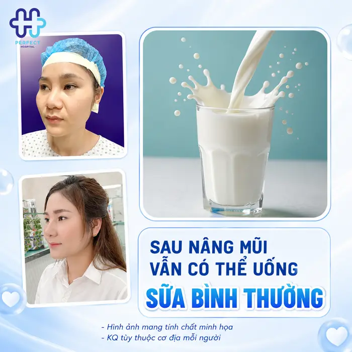 Nâng Mũi Có Uống Sữa Được Không? Giải Đáp Từ Chuyên Gia
