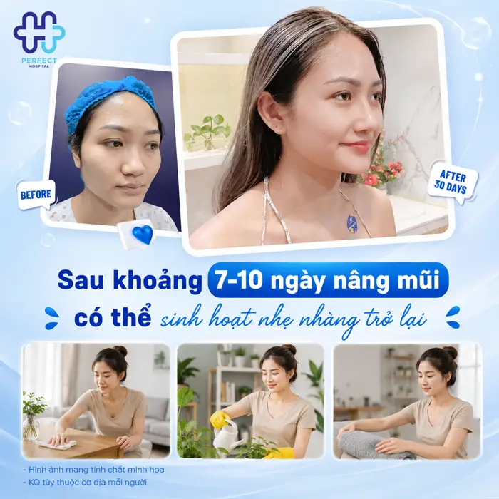 Sau Khi Nâng Mũi Nên Nằm Hay Ngồi? Hướng Dẫn Chuẩn Từ Chuyên Gia