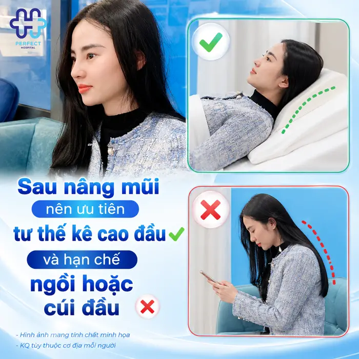 Sau Khi Nâng Mũi Nên Nằm Hay Ngồi? Hướng Dẫn Chuẩn Từ Chuyên Gia