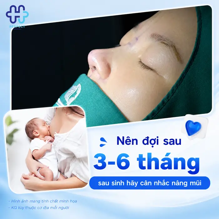Sau Sinh Bao Lâu Thì Nâng Mũi Được? Thời Điểm An Toàn Nhất