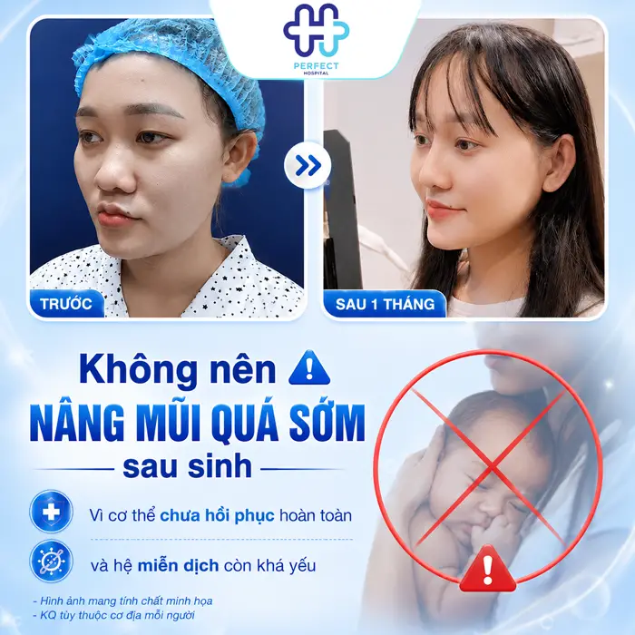 Sau Sinh Bao Lâu Thì Nâng Mũi Được? Thời Điểm An Toàn Nhất