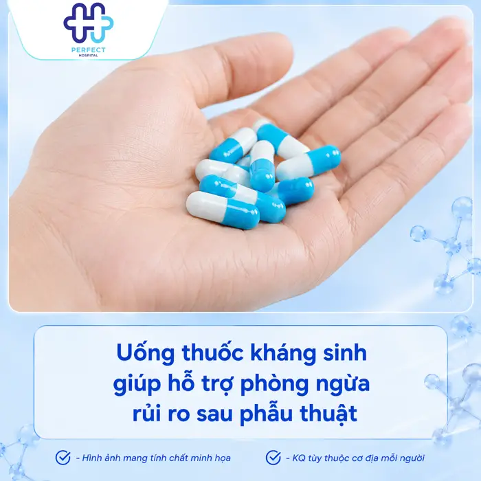 Nâng Mũi Uống Kháng Sinh Bao Lâu? Hướng Dẫn Chăm Sóc Đúng Cách