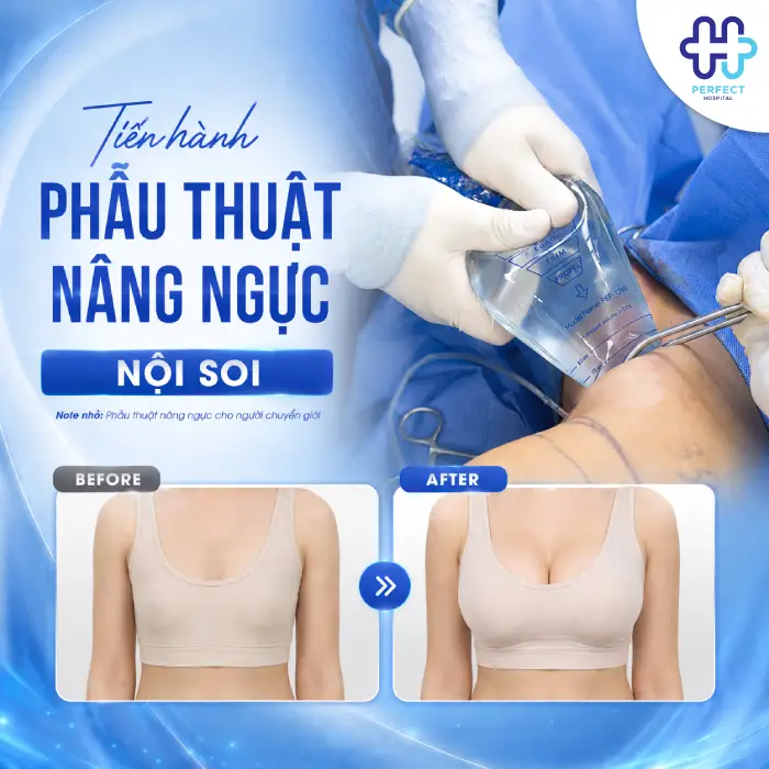 Nâng Ngực Cho Nam Giới Là Gì? Quy Trình Và Những Điều Cần Biết