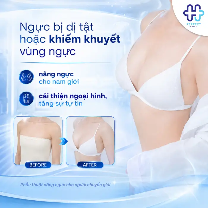Nâng Ngực Cho Nam Giới Là Gì? Quy Trình Và Những Điều Cần Biết
