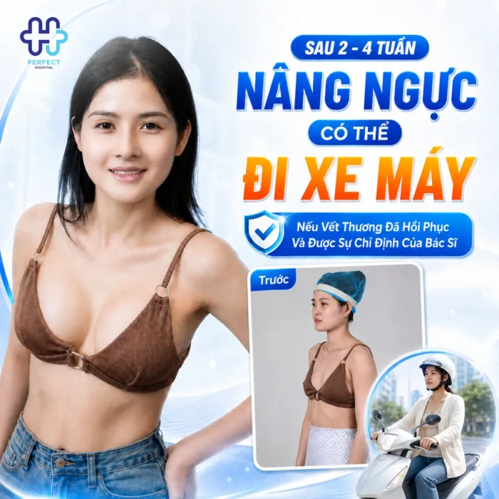 Nâng Ngực Bao Lâu Được Đi Xe Máy? Mốc Thời Gian An Toàn Cần Biết