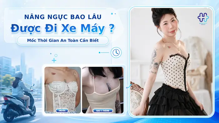 Nâng Ngực Bao Lâu Được Đi Xe Máy? Mốc Thời Gian An Toàn Cần Biết