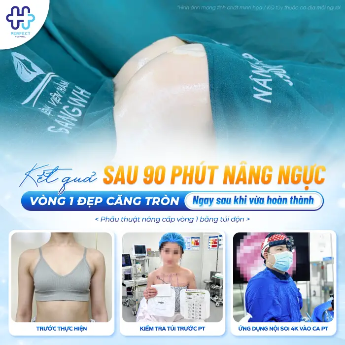 Phẫu Thuật Nâng Ngực Mất Bao Lâu? Bác Sĩ Giải Đáp