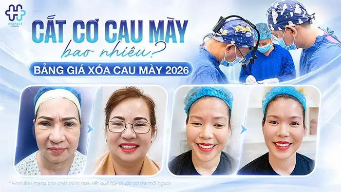 Cắt Cơ Cau Mày Giá Bao Nhiêu? Cập Nhật Chi Phí Mới 2026