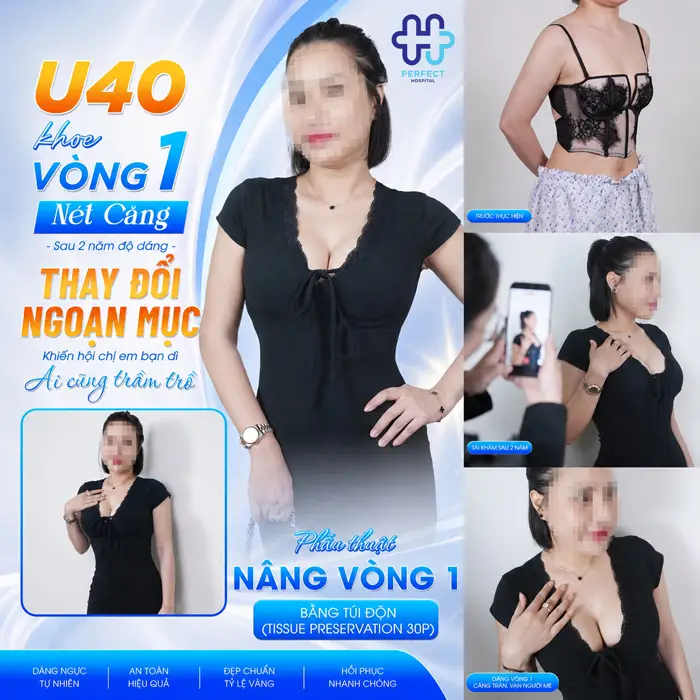 Nâng Ngực Giá Bao Lâu? Bảng Giá Nâng Ngực Mới 2026