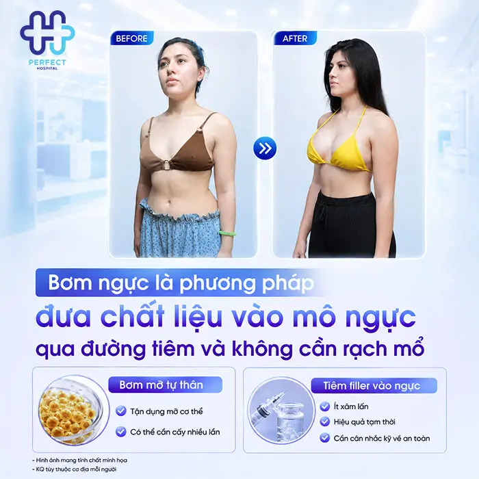 Bơm Ngực Khác Gì Nâng Ngực? Bác Sĩ Giải Đáp Chi Tiết