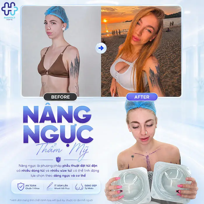 Bơm Ngực Khác Gì Nâng Ngực? Bác Sĩ Giải Đáp Chi Tiết