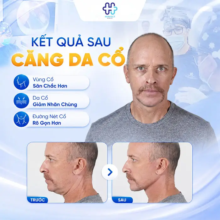 Căng Da Cổ Giá Bao Nhiêu? Bảng Giá Chi Tiết Và Những Điều Cần Biết