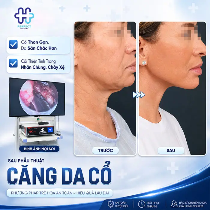 Căng Da Cổ Giá Bao Nhiêu? Bảng Giá Chi Tiết Và Những Điều Cần Biết