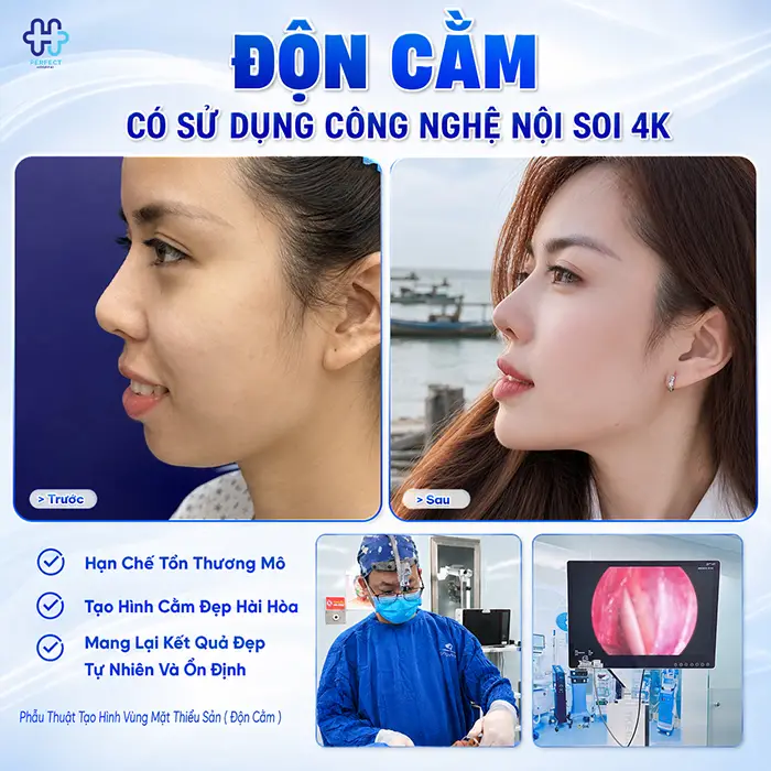 Độn Cằm Có Đau Không? Chuyên Gia Giải Đáp Chi Tiết Từ Quy Trình Đến Hồi Phục