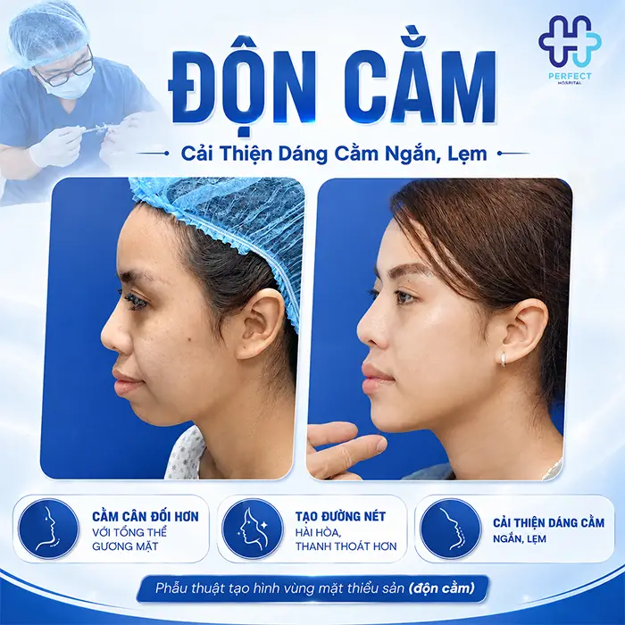 Độn Cằm Có Gây Mê Không? Giải Đáp Chi Tiết Từ Chuyên Gia