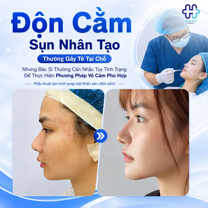 Độn Cằm Có Gây Mê Không? Giải Đáp Chi Tiết Từ Chuyên Gia