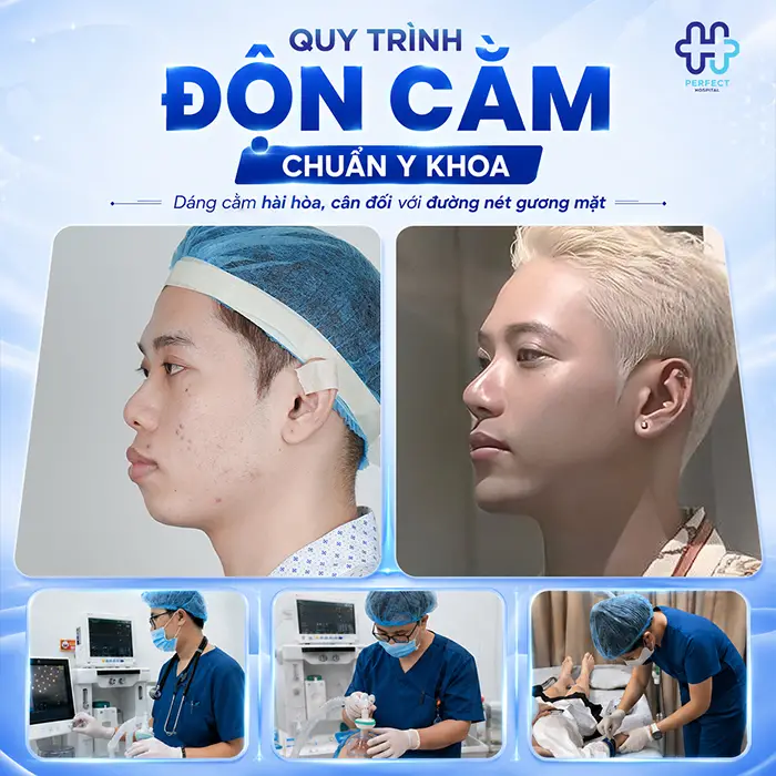 Độn Cằm Có Gây Mê Không? Giải Đáp Chi Tiết Từ Chuyên Gia