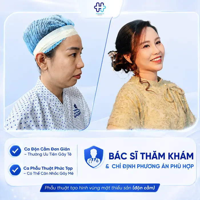 Độn Cằm Có Gây Mê Không? Giải Đáp Chi Tiết Từ Chuyên Gia