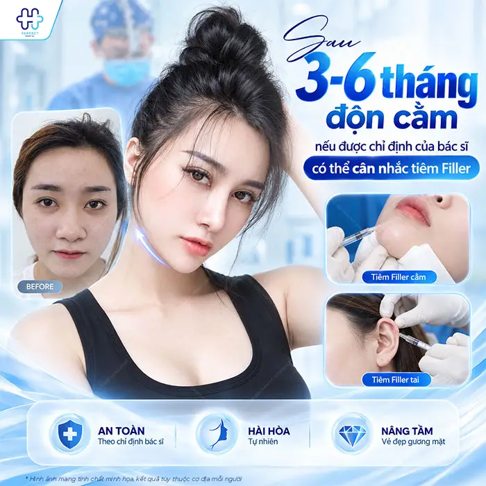 Độn Cằm Rồi Có Tiêm Filler Được Không? Bác Sĩ Giải Đáp Chi Tiết